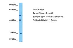 SNRNP48 Rabbit anti-Mouse, Polyclonal, Novus Biologicals 0.1ml; Unconjugated:Antibodies,